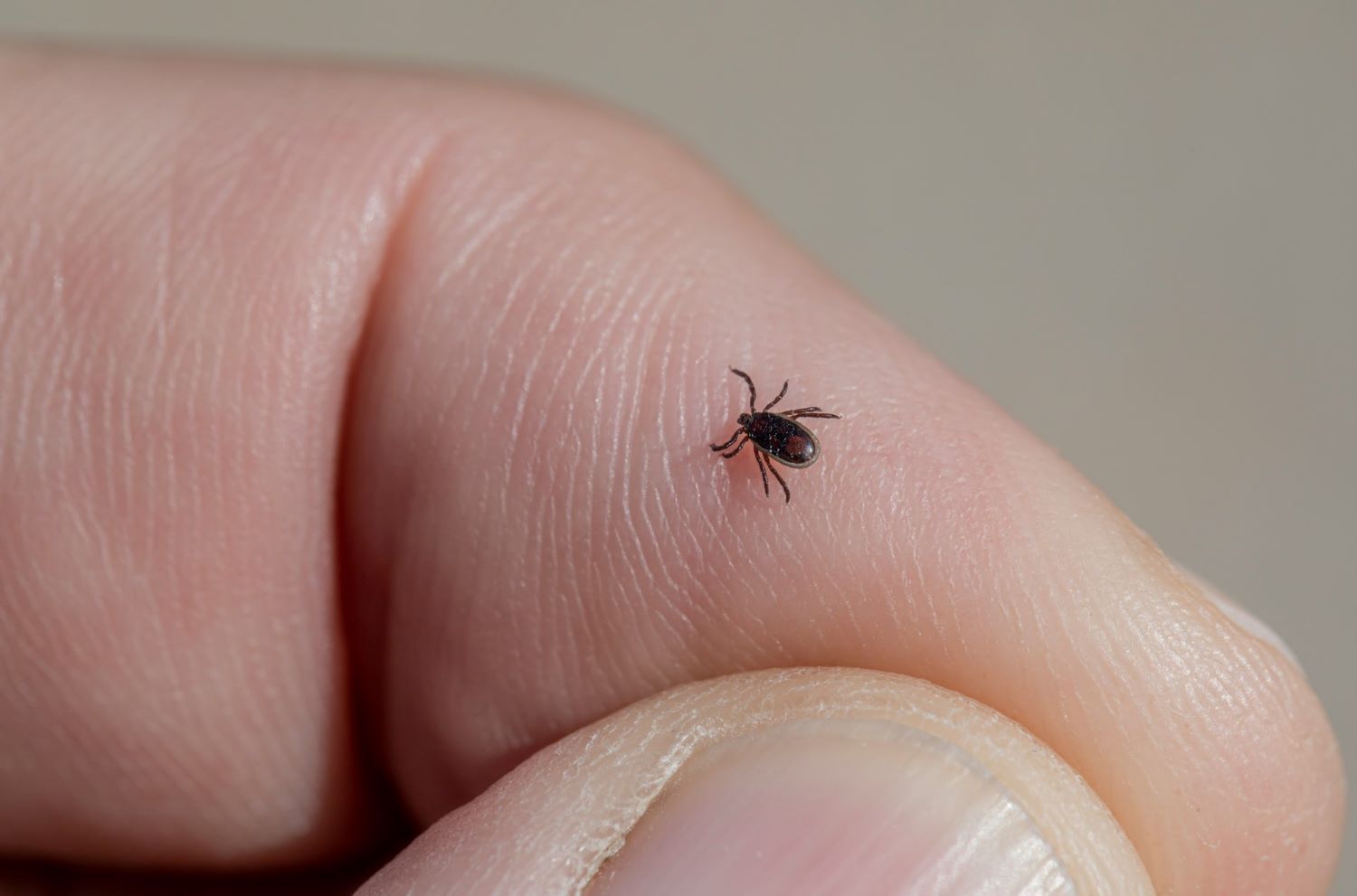 Krpelj vam se zakačio za kožu? Evo što nikako ne smijete raditi nakon ugriza